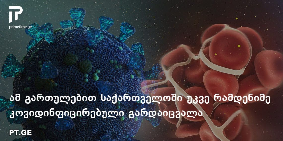 თრომბოემბოლია, როგორც კორონავირუსის ერთ-ერთი ყველაზე სახიფათო გართულება – რა უნდა ვიცოდეთ ამ დაავადების შესახებ